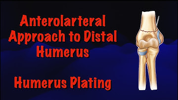 Anterolateral Approach to Distal Humerus: Humerus Plating Surgical Technique
