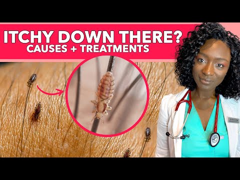 Video: Vinegar and garlic for intimate infections? Gynecologists grab their heads when they hear this