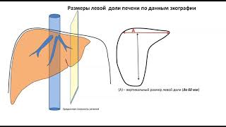 Лекция: Размеры печени  (с демонстрацией на пациенте)