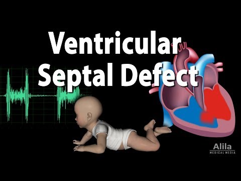 Video: Ventricular Septal Defect (VSD) la câini