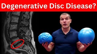 4 MustDo Exercises For Degenerative Discs In Lower Back (Don't Skip These)