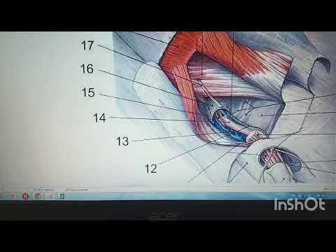 Паховый канал. Стенки. Как понять? Проще некуда