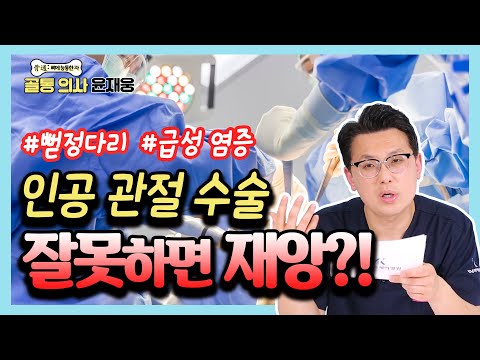   무릎 인공 관절 수술 이것 만은 꼭 알고 결정하세요 골통 의사 윤재웅 22 인공관절수술