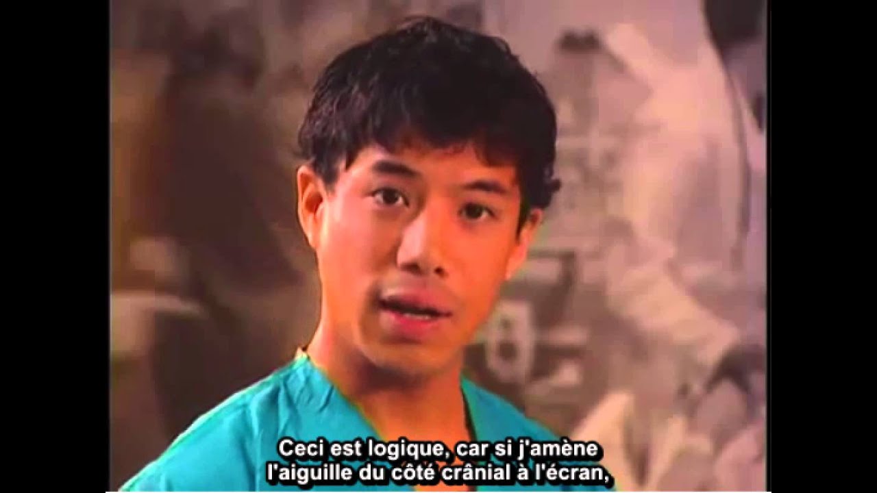 Réaliser un bloc nerveux infraclaviculaire au niveau du plexus brachial par guidage échographique