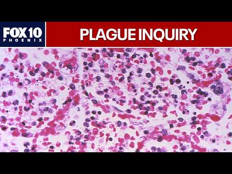 Questions mount over possible Russia plague death | FOX 10 Phoenix