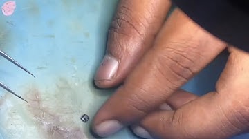 Tecno Spark 7 Lcd Light Solution 🔥🔥🔥