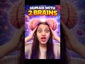 Tumhare Paas 2 Dimaag Hain?! 🤯 Ye Sach Hai! #Shorts