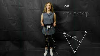 ECG: The augmented limb leads aVF, aVR and aVL