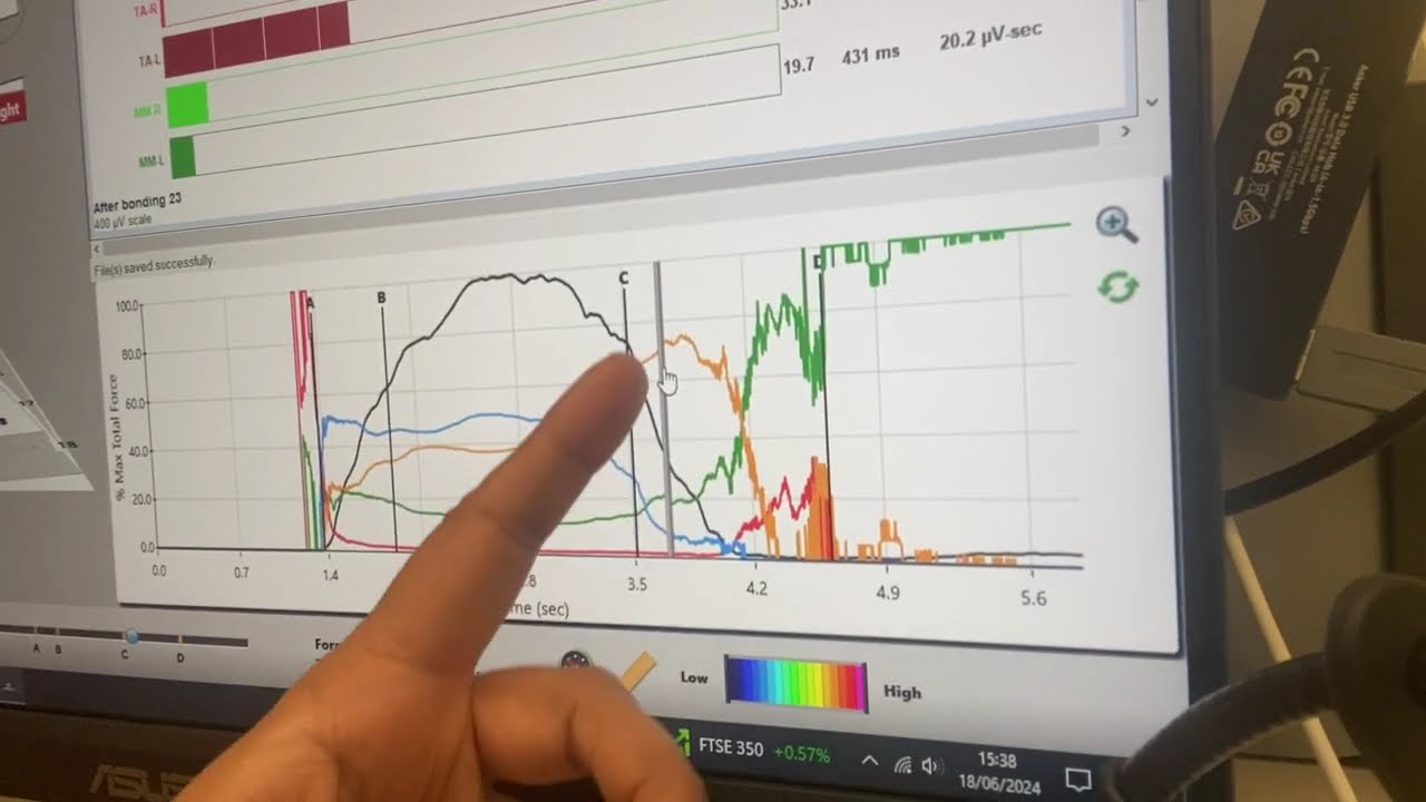 TMJ Relief & Better Bites Dr. Tasleem Ahmed on Posterior Disclusion-T-Scan Technology-DTR Therapy