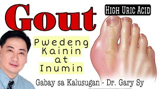 GOUT: PWEDENG Kainin at Inumin - Dr. Gary Sy