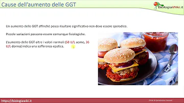 Cosa si intende per gamma di prodotti?