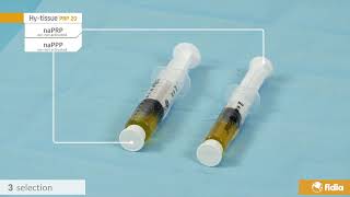 Fidia PRP Kits