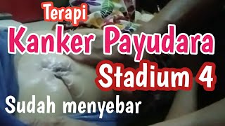 Terapi pijat urut kanker payudara | Ahli terapi alternatif