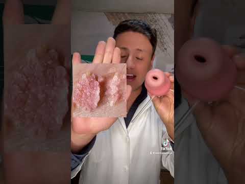 Vídeo: 3 maneres de prevenir la infecció pel VPH (infecció pel virus del papil·loma humà)