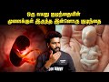 குழந்தையின் மூளைக்குள் கண்டுபிடிக்கப்பட்ட இன்னொரு குழந்தை | Saravanan Decodes