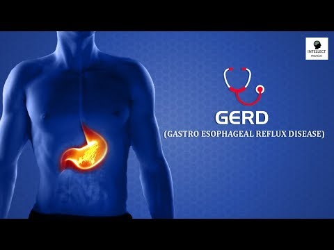 GERD (gastroesophageal reflux disease) I ACIDITY | HEARTBURN: symptoms,causes, treatment