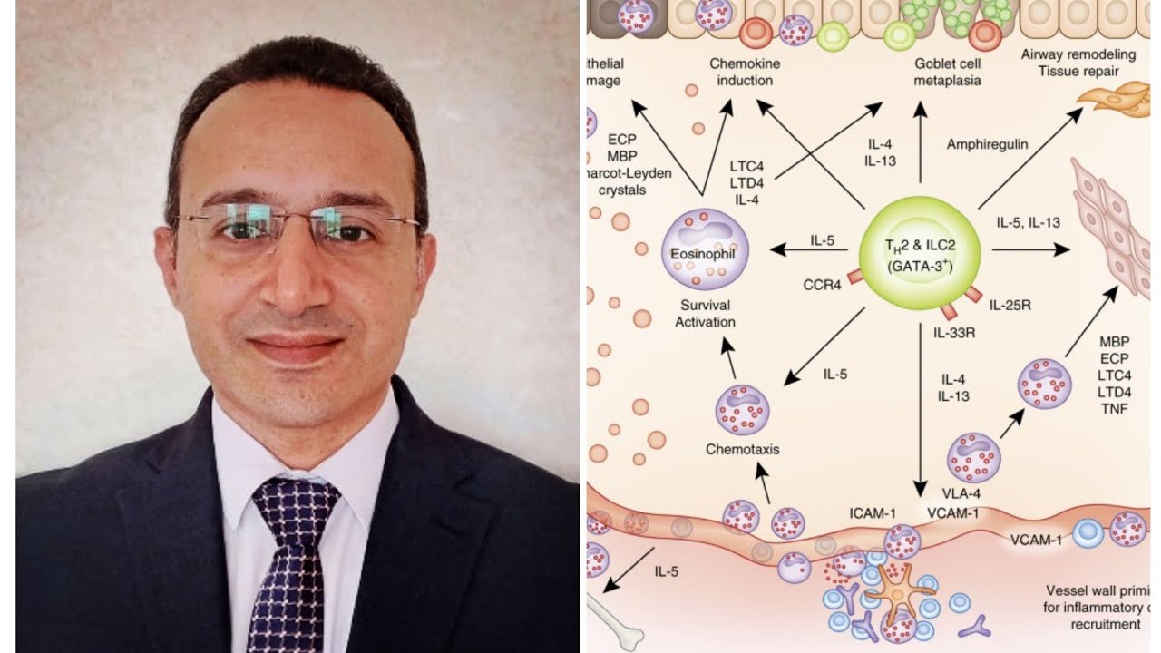 العلاج البيولوجي للربو الشُعبي
