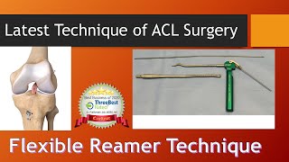 Flexible  Reamer Technique of ACL Reconstruction . English