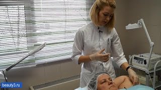 видео: Решаем проблему повышенного потоотделения с помощью инъекций ботулотоксина картинка: Решаем проблему повышенного потоотделения с помощью инъекций ботулотоксина