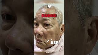 EMPulse - 脸部外观看起来对称｜Perfect Doc