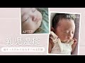 【酷い乳児湿疹】始まった日から治るまでの全記録✨保湿剤/お薬💊