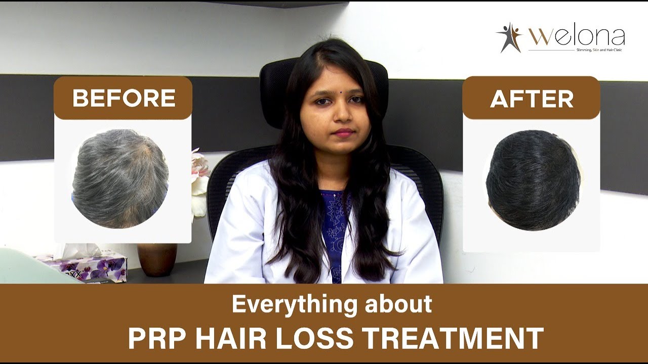 PRP Treatment in Chennai  PRP Therapy Cost in Chennai for Hair Fall   DermaClinix