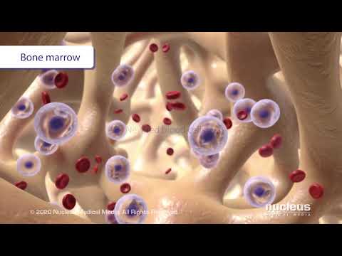 Video: Hoe chronische nierziekte bloedarmoede veroorzaakt?