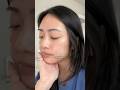 my skin transformation #skincare #acne #sensitiveskin #transformation