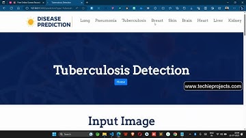 Disease Prediction System using Machine Learning | Machine Learning Projects