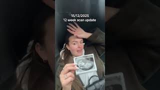 12 weeks pregnancy scan🍼 #pregnant #pregnancy #baby #babyscan #pregnancyjourney
