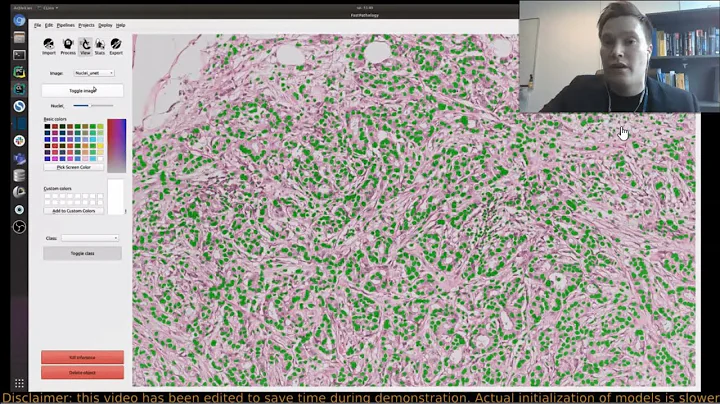 FastPathology: An Open-source Platform for Artificial Intelligence-based Digital Pathology (IPCAI20)