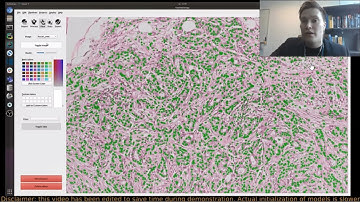 FastPathology: An Open-source Platform for Artificial Intelligence-based Digital Pathology (IPCAI20)