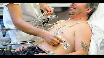 Quels sont les 4 signes de l'insuffisance cardiaque