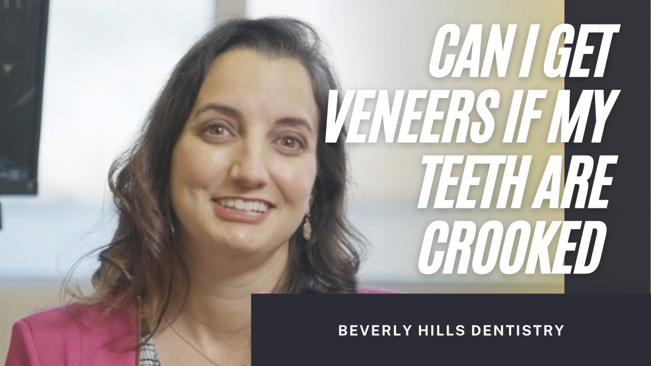 CAN I GET PORCELAIN VENEERS IF MY TEETH ARE VERY CROOKED | Beverly Hills Dentistry