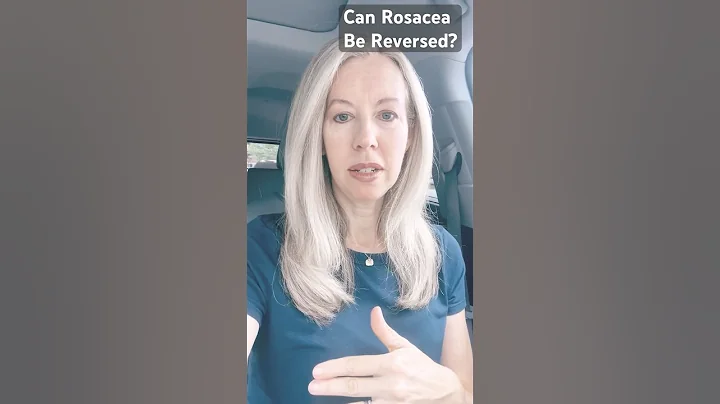 How can you heal rosacea? You can start by focusing on gut health. #rosaceadiet #rosaceatips