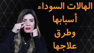 اسباب الهالات السوداء وطرق علاجها