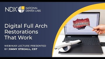 Digital Full Arch Restorations That Work