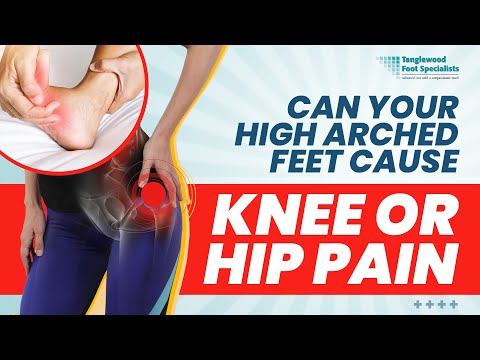 Video: A avea picioare arcuite poate cauza probleme?