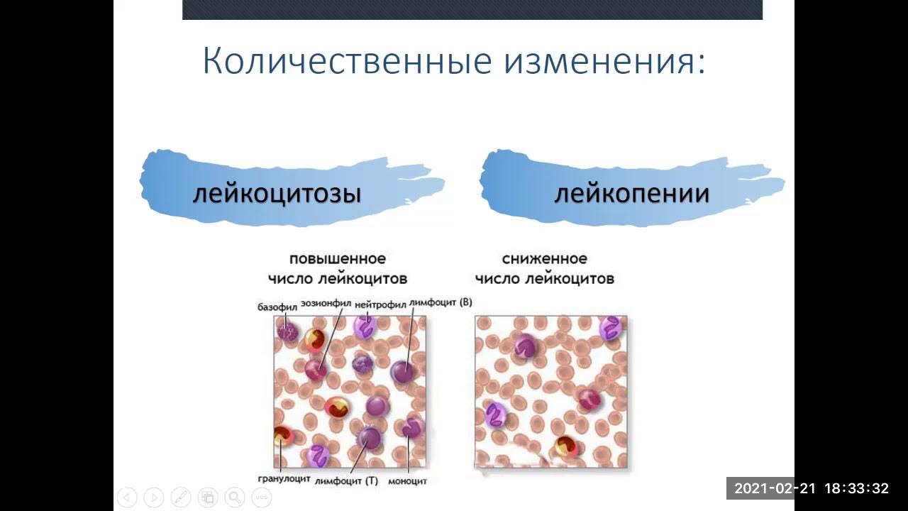 Лейкоцитоз и лейкопения. Лейкоцитозы и лейкопении патофизиология. Патогенез лейкоцитоза. Лейкоцитоз классификация патофизиология.