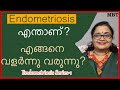 Endometriosis -1 | What Is Endometriosis ? How Does It Develop ? എന്താണ്? എങ്ങനെ വളര്‍ന്നു വരുന്നു?