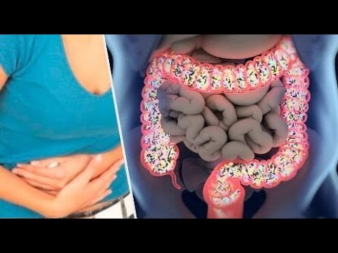 Wideo: Zapalenie żołądka I Jelit U Dzieci - Objawy, Leczenie, Ostre Zapalenie żołądka I Jelit U Dzieci