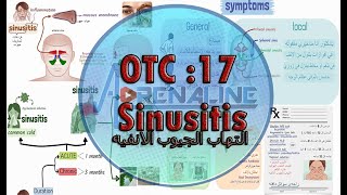 الحلقة 17 فى  OTC Course ◀ التهاب الجيوب الانفيه ( الاسباب - الاعراض - العلاج )  OTC sinusitis