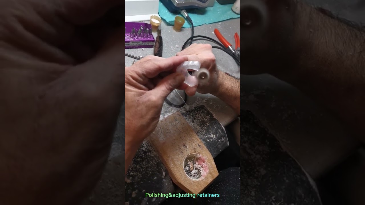 Inside the dental lab 