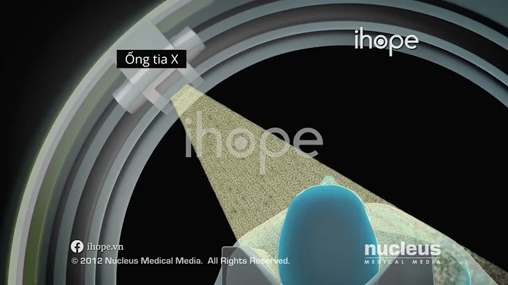 Chụp cắt lớp vi tính - Chụp CT