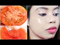 In 2 DAYS-Get Visible GLASS skin | Apply Tomato on Your Darkspots and See the Magic