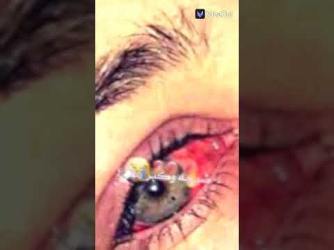 اغنية حزينة لايك وشوفو الوصف