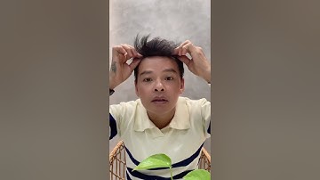 Miếng dán che hói M, trán cao nhanh chóng tiện lợi và dễ sử dụng