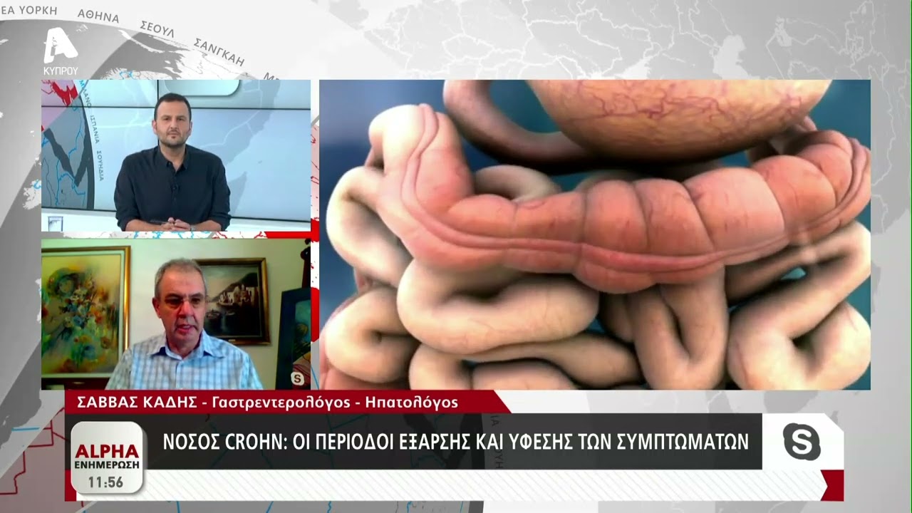 Νόσος crohn: Η χρόνια νόσος που 