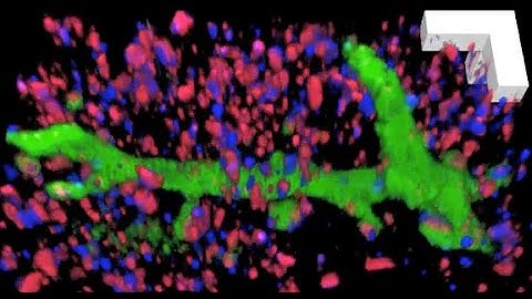 Expansion microscopy brings the brain in 3-D into focus