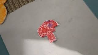 Logos Get Expelled In Angry P-Heads Cl Thats Lot You Test